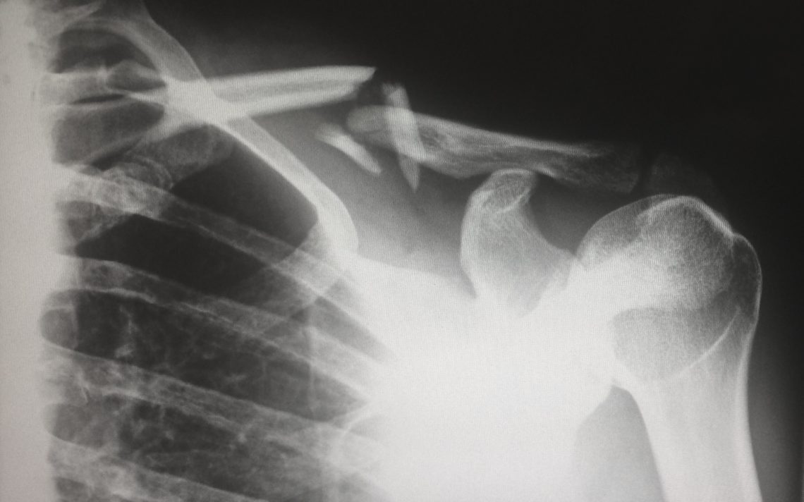 Signs You May be a Hypochondriac